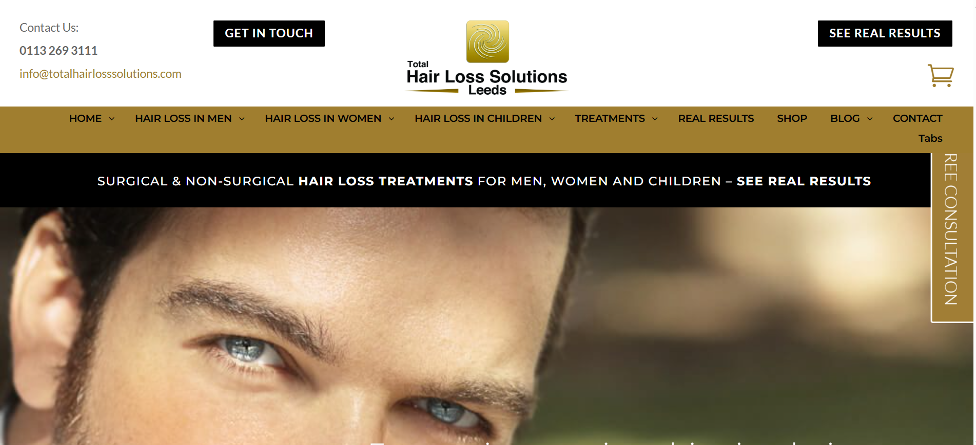 PRP Treatment in Yorkshire Near Me – A Natural Solution for Healing and Rejuvenation