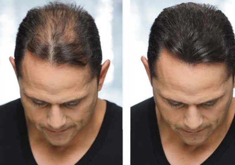 Achieving Radiant Skin Through Dermatologist Laser Treatment for Lasting Results