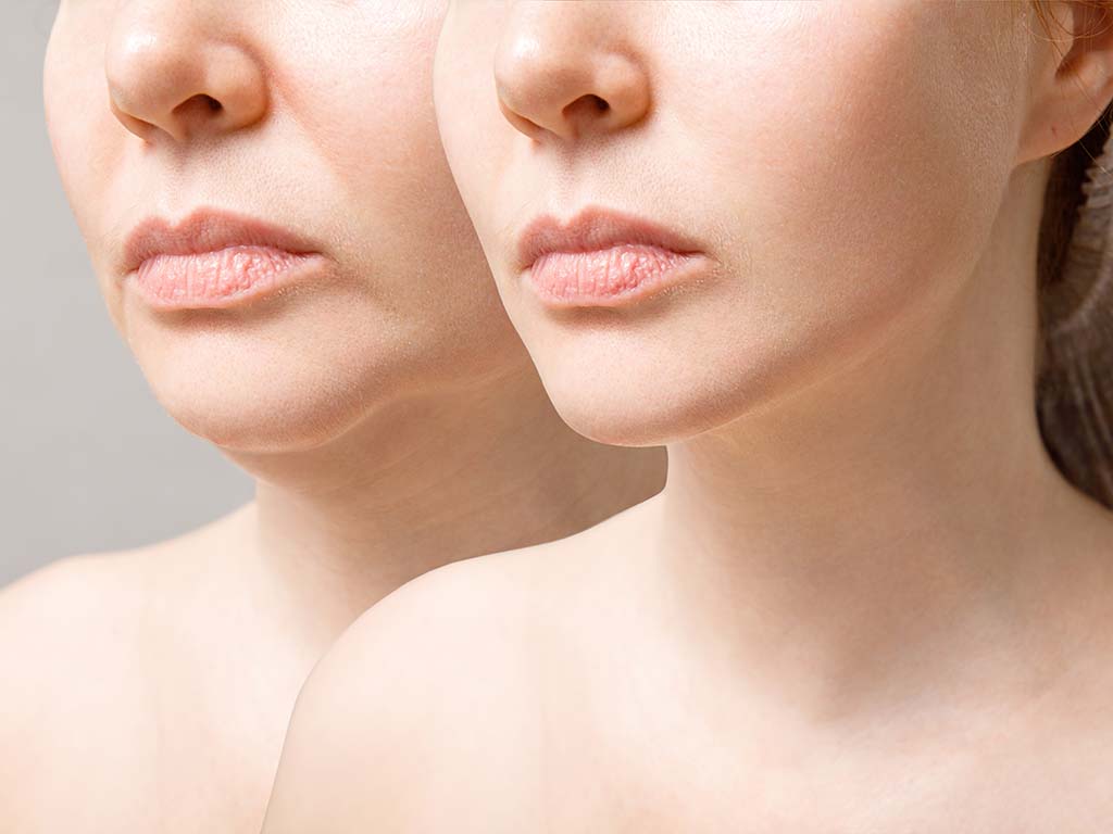 How Do Neuromodulators Make Me Look Younger?